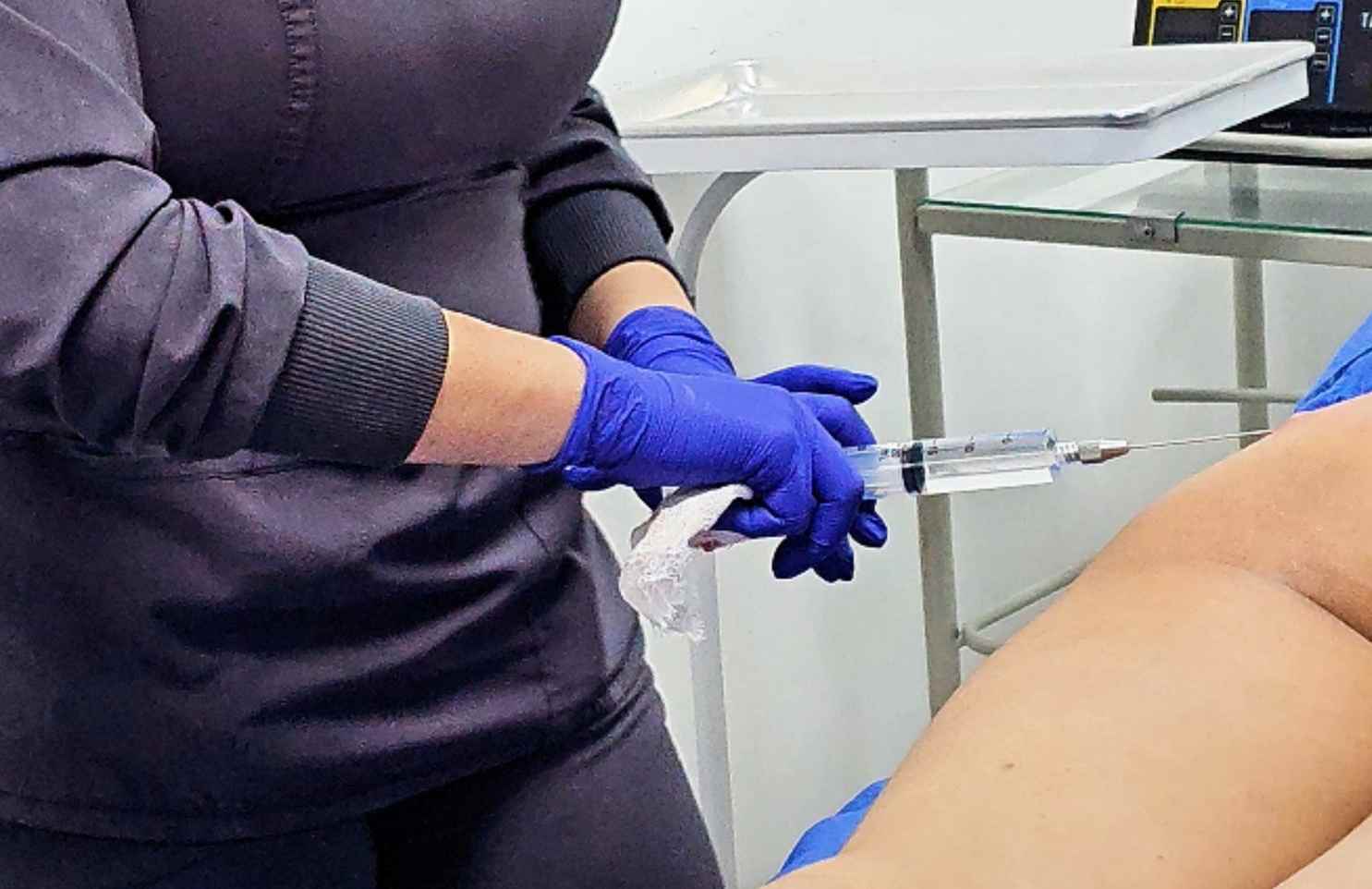 acido hialuronico en gluteos son permanentes