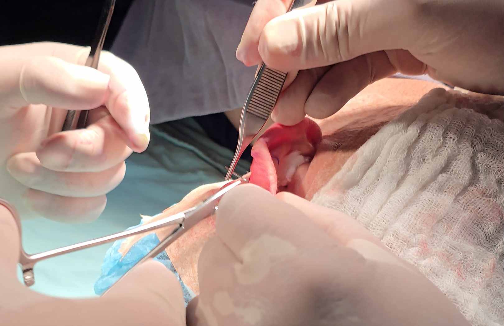 como es la cirugia de orejas