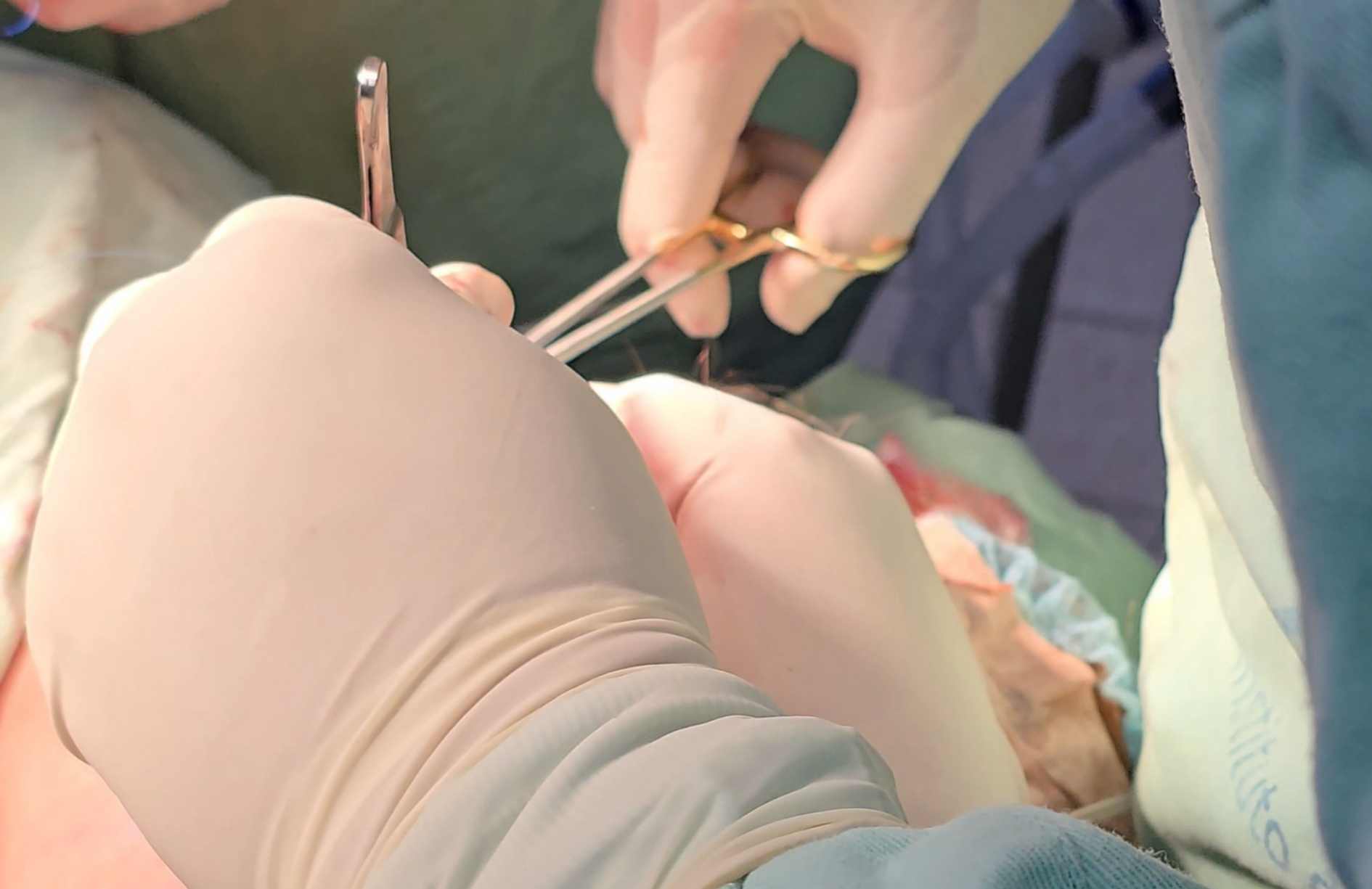 cuanto dura la lobuloplastia