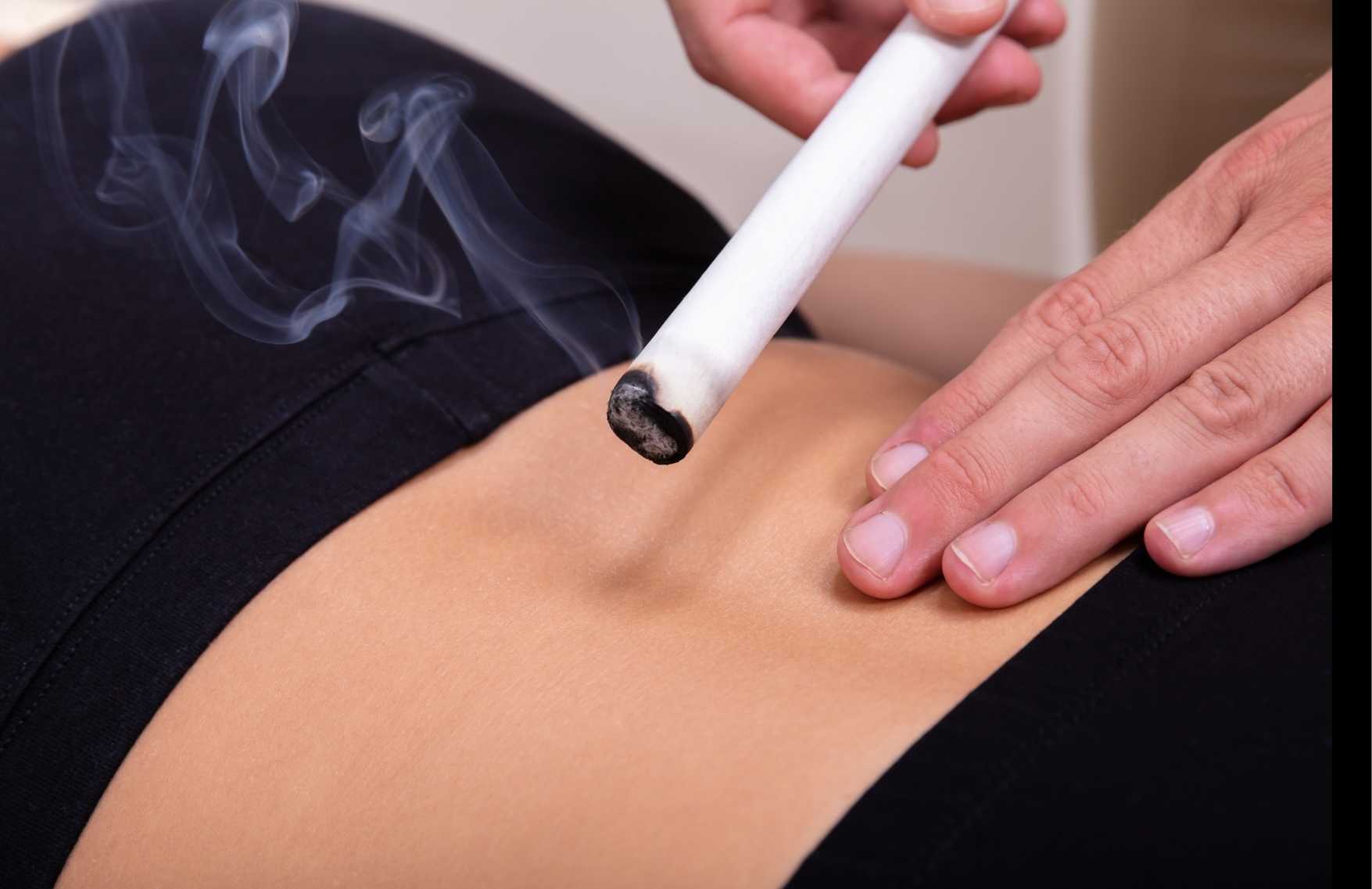 en que consiste la moxibustion