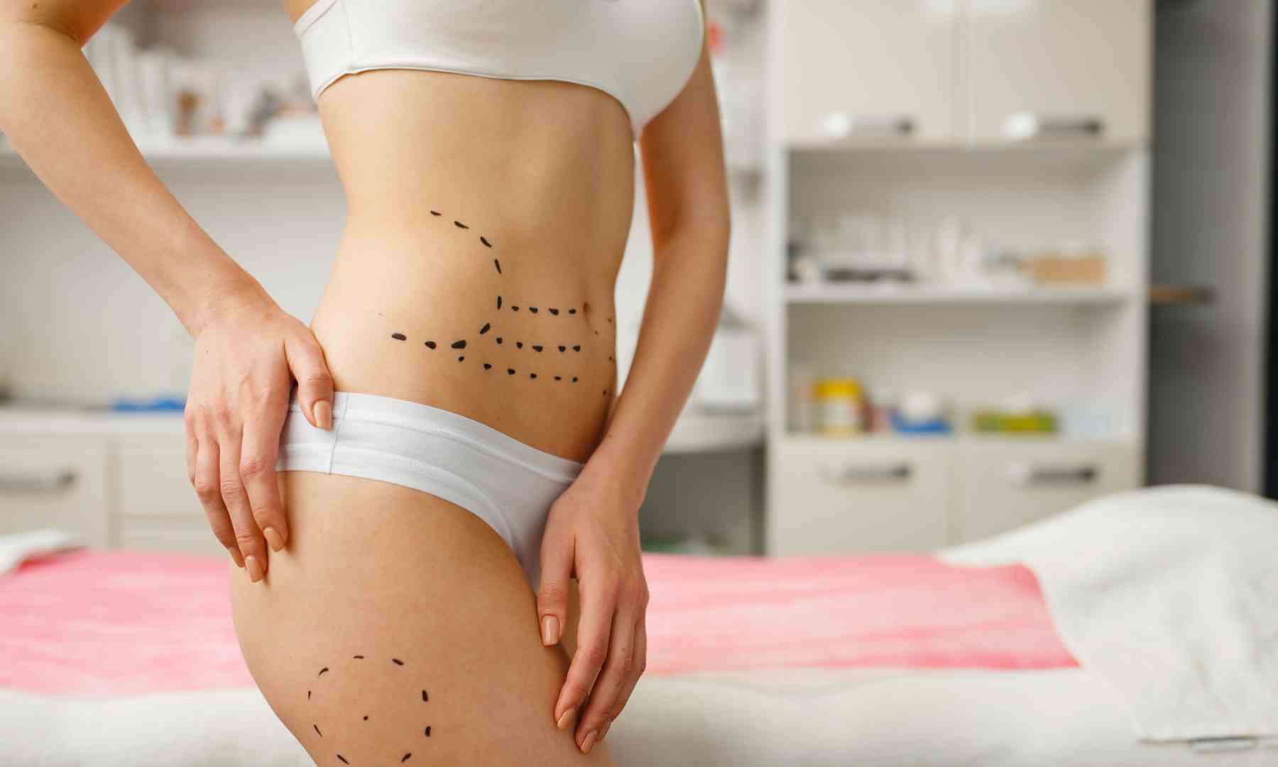 Como funcuiona el laser en endolifting abdomen