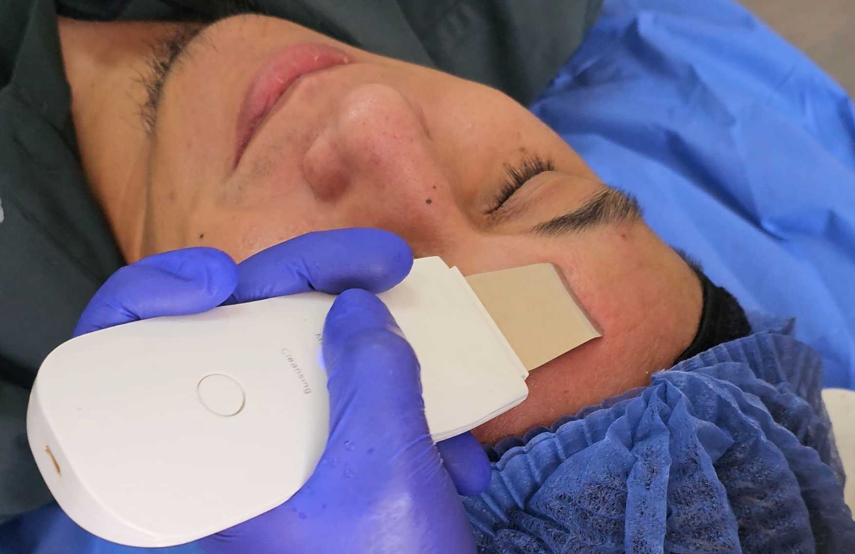 extraccion espinillas