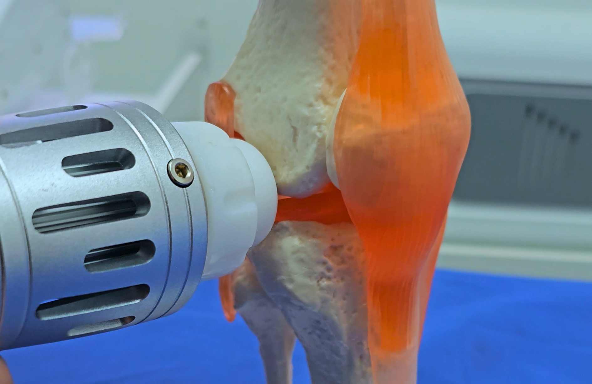 ondas de choque para el dolor de rodillas