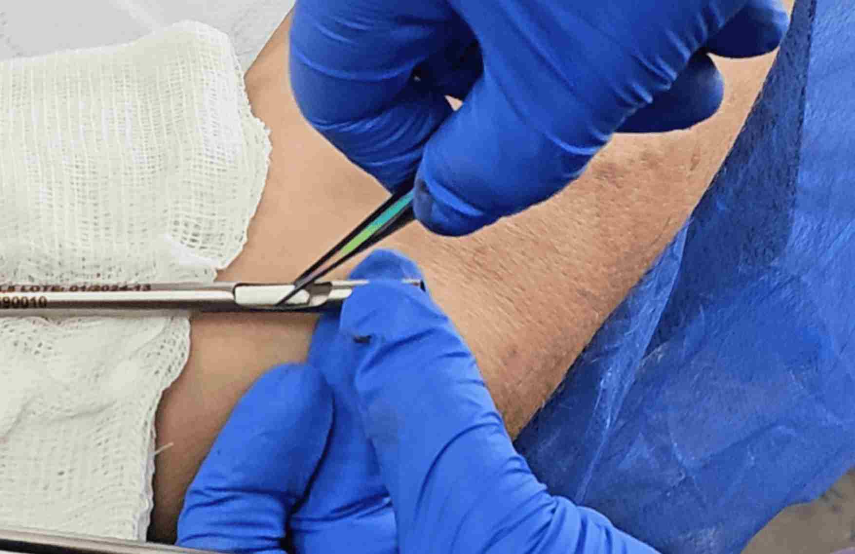 Por que elegir pellets de testosterona