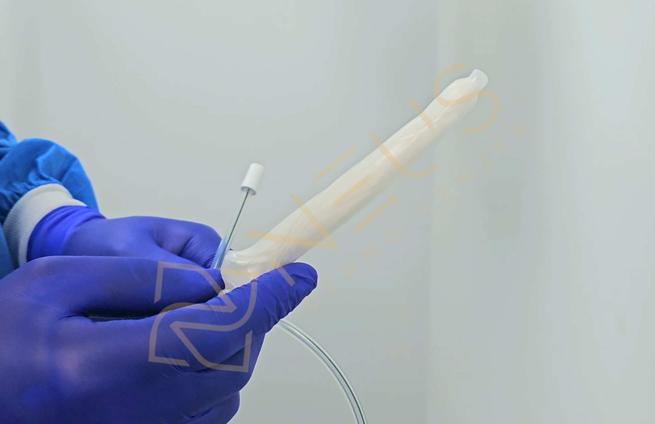 que es el balon gastrico