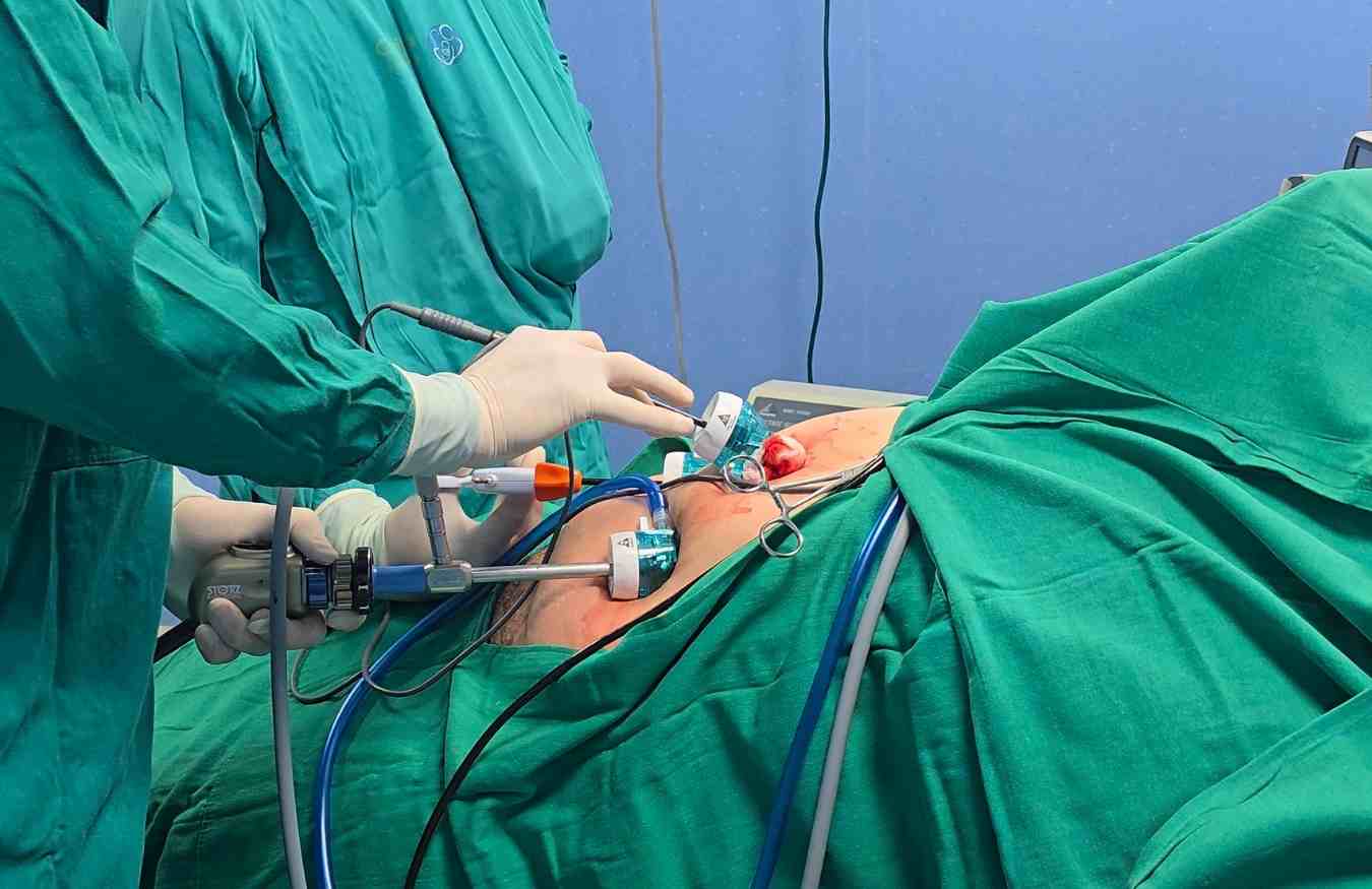 que es la manga gastrica