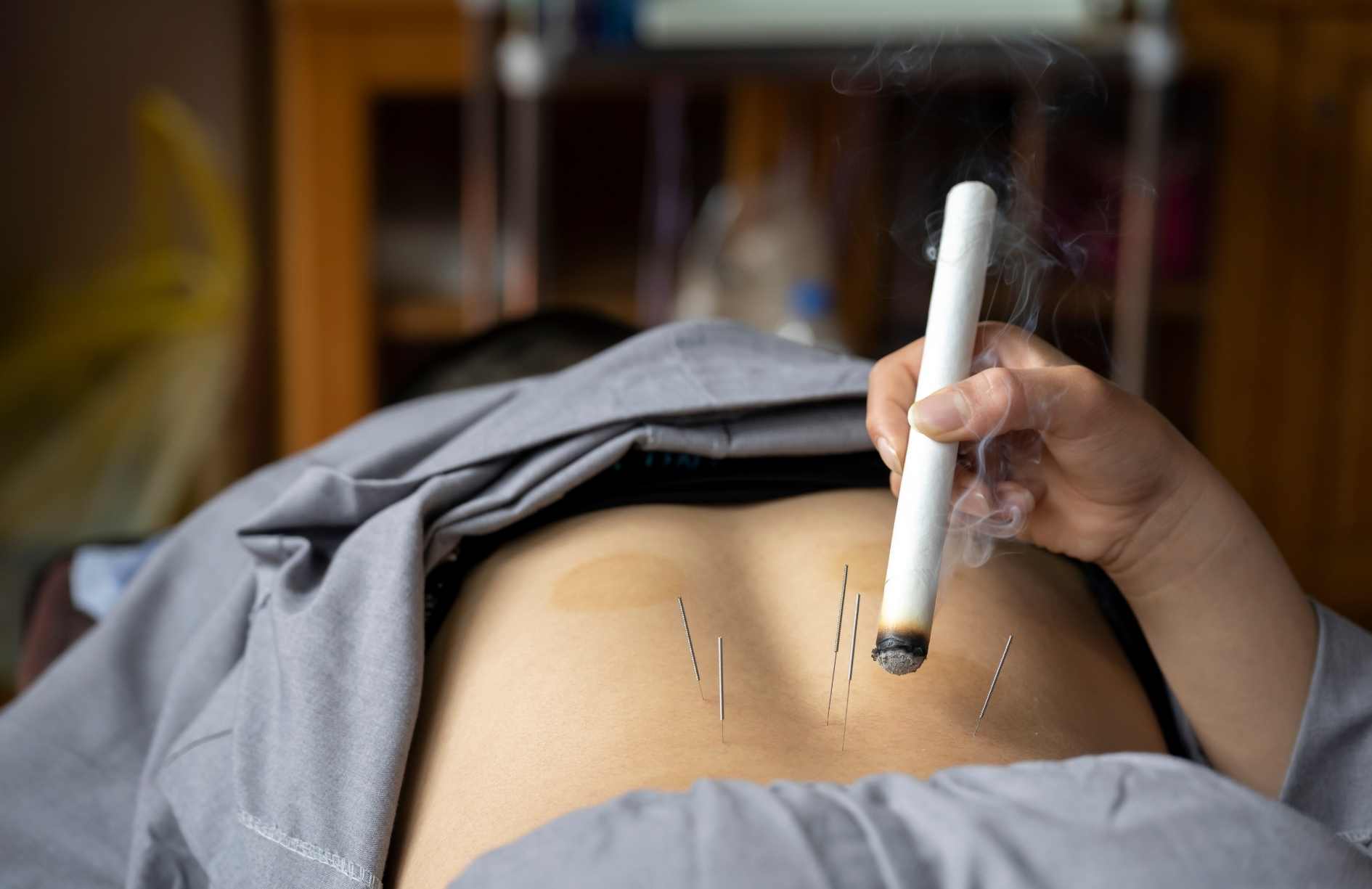 que es la moxibustion