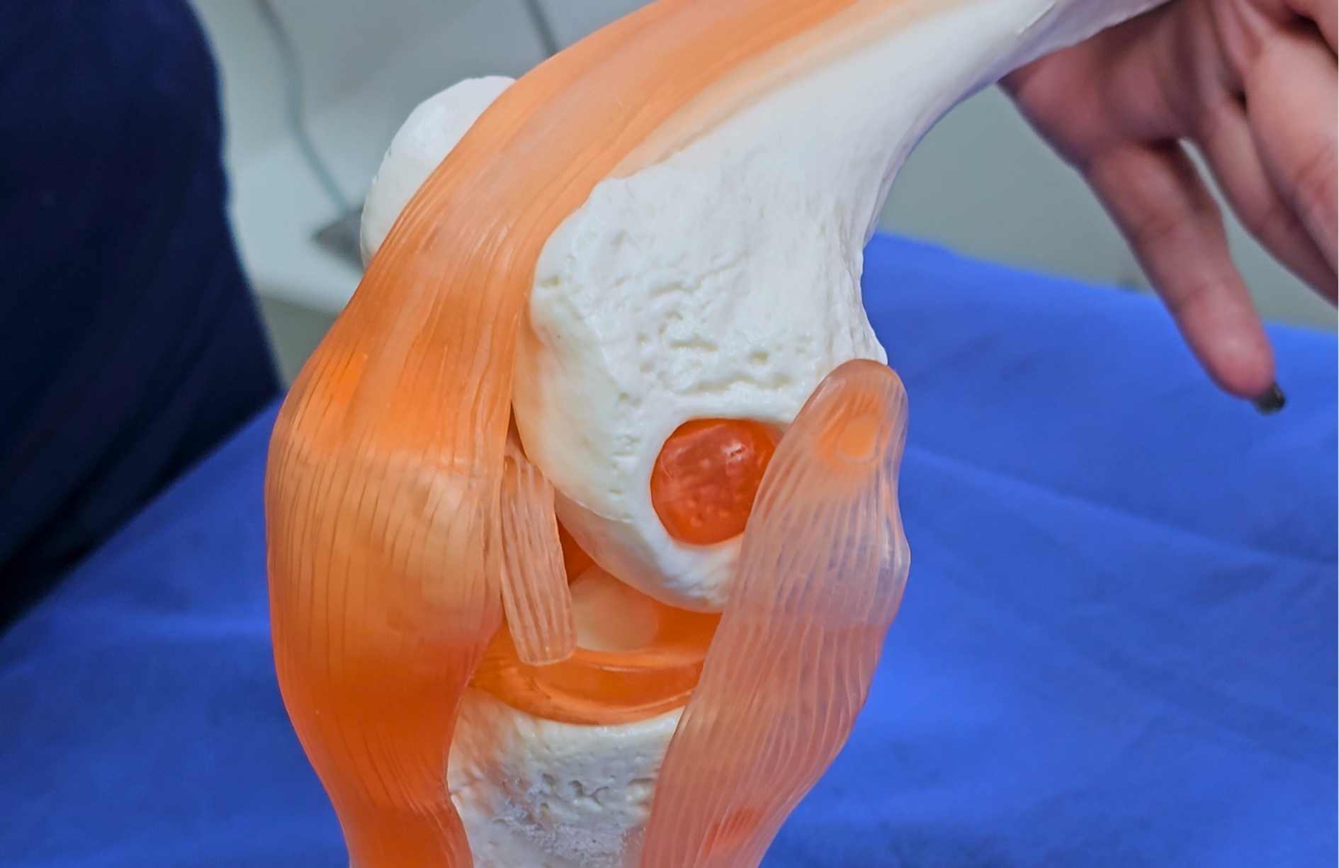 que puede causar dolor de rodilla