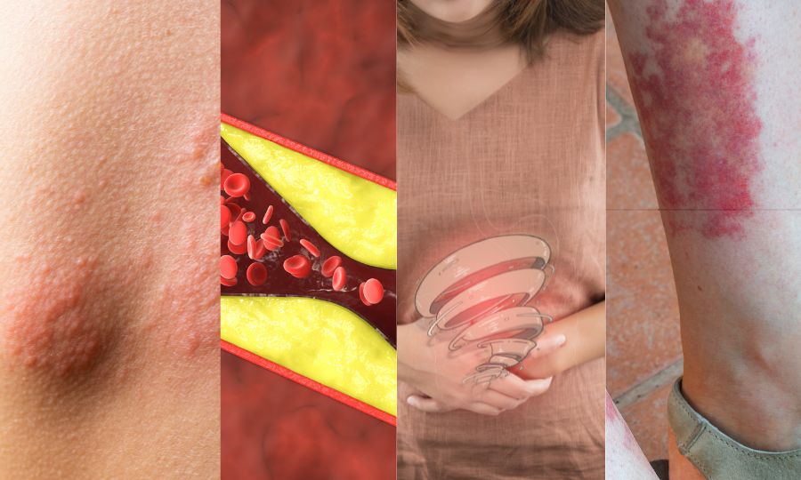 riesgos del endolift en estetica