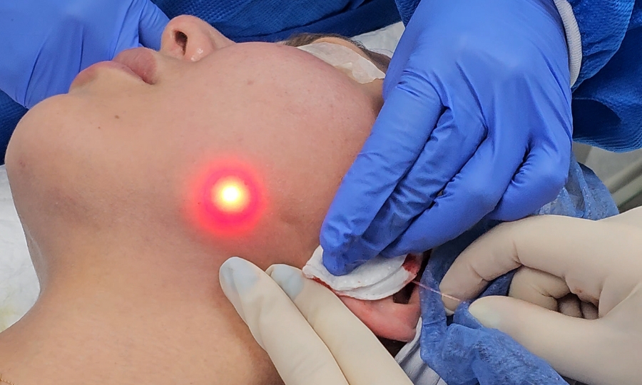Ventajas de un lifting facial