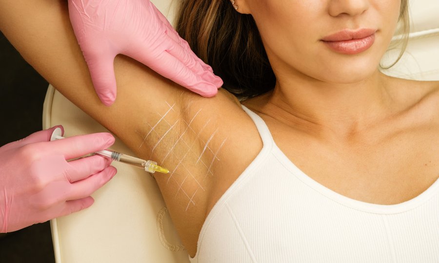 botox axila mujer