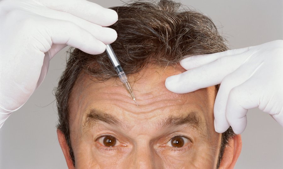 botox doctor frente