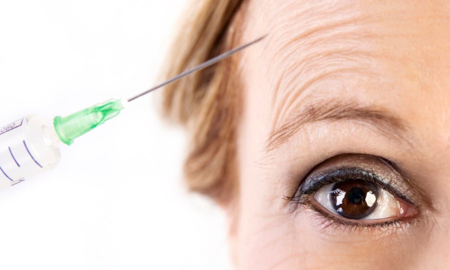 botox inyeccion frente