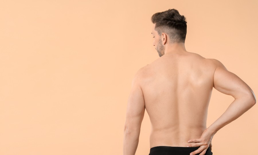 espalda acne corporal