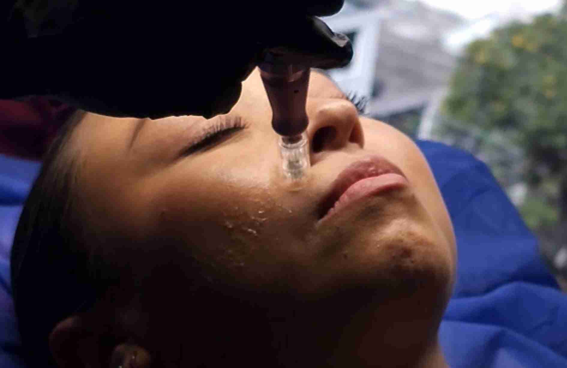 hidratacion facial quito