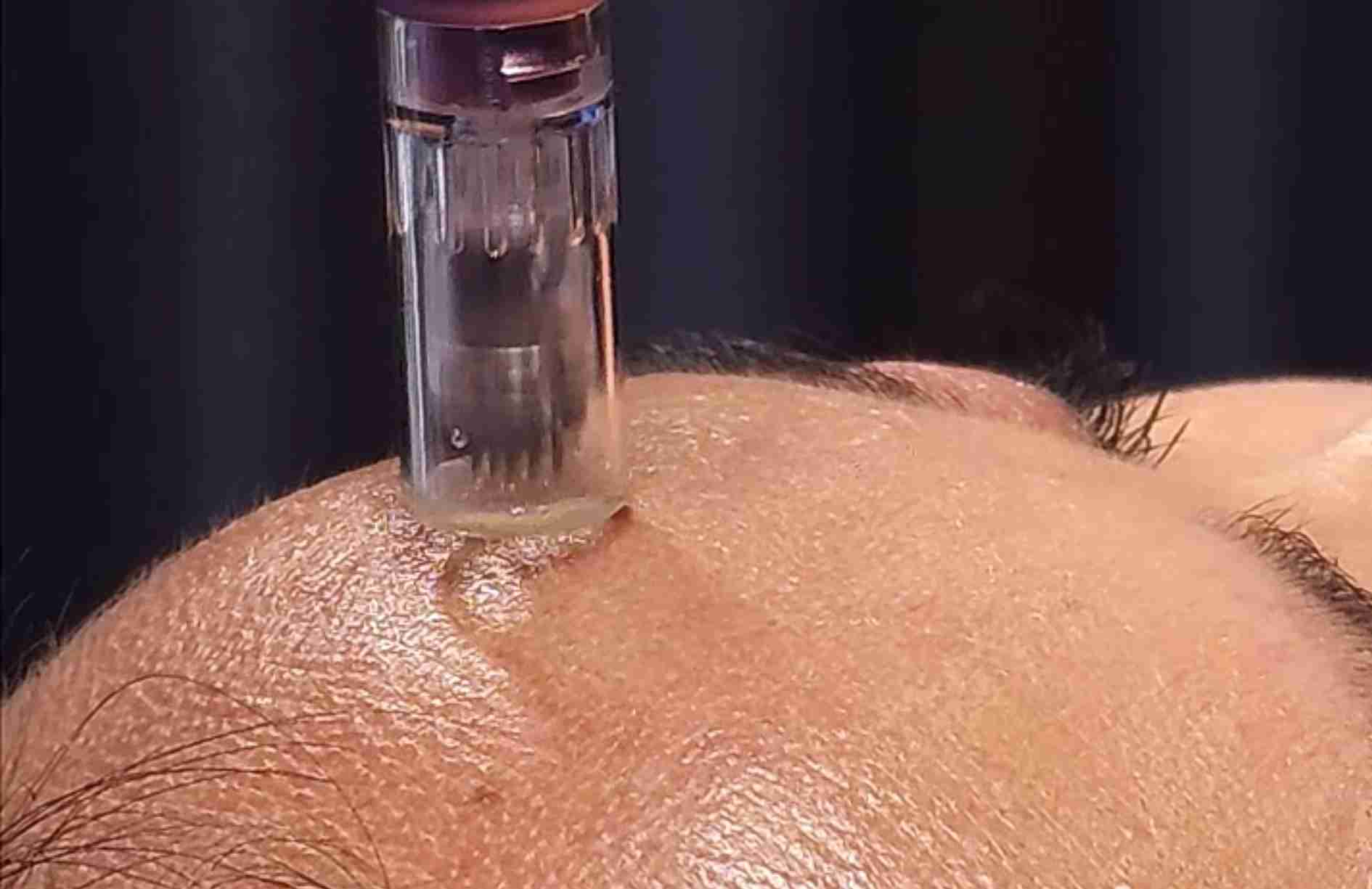 precio skin booster
