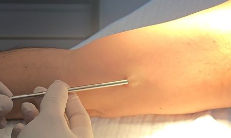 como se coloca el chip de la potencia
