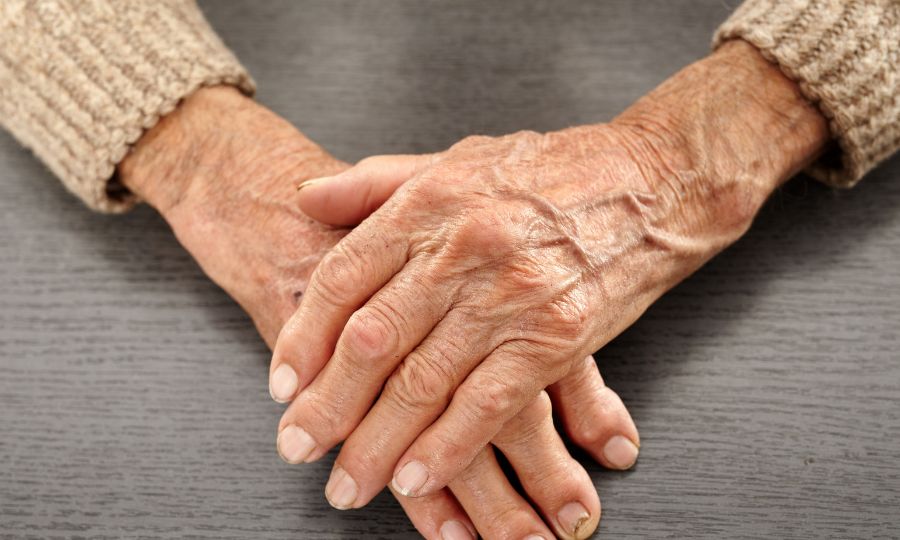 ¿Cómo quitar las arrugas de las manos? Rejuvenecimiento de manos resecas con ácido hialurónico
