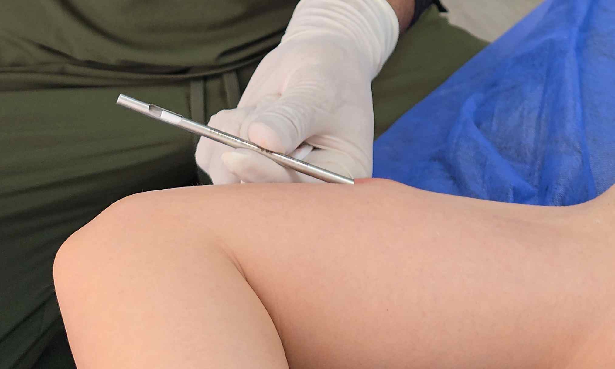 Vitalichip en Quito – ¿El chip de la juventud tiene efecto antienvejecimiento?