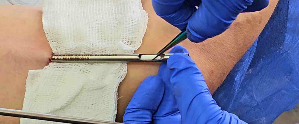 Chip del semental o de tadalafilo en Ecuador - ¿Es mejor que el viagra?