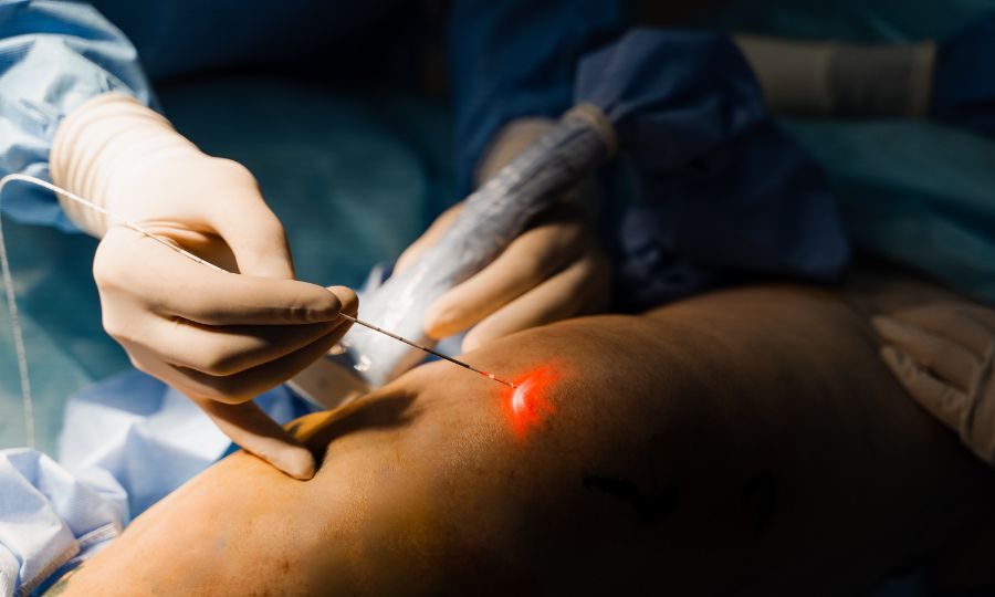 ¿Quién debe realizar endolifting? ¿Centro médico o estética?