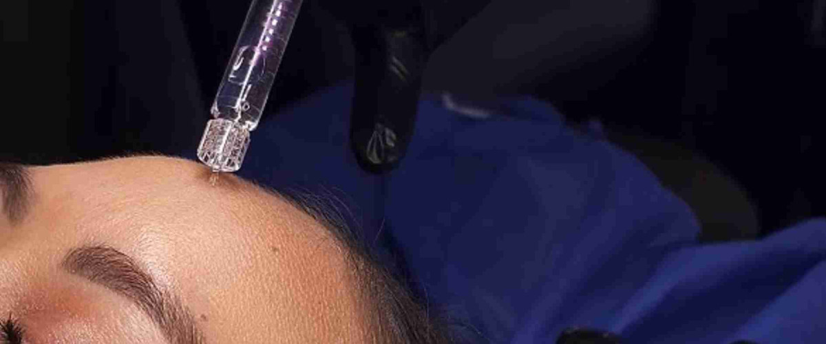 &iquest;Cu&aacute;nto vale el Skin Booster en Ecuador? 50% descuento en hidrataci&oacute;n facial con &aacute;cido hialur&oacute;nico