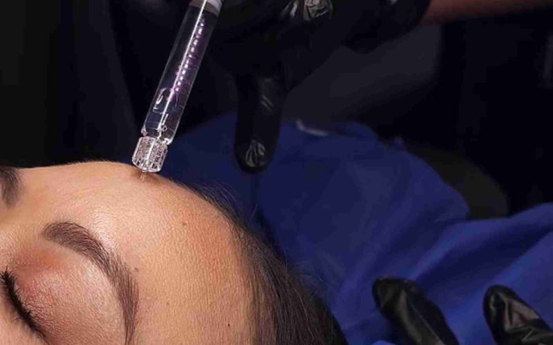 &iquest;Cu&aacute;nto vale el Skin Booster en Ecuador? 60% descuento en hidrataci&oacute;n facial con &aacute;cido hialur&oacute;nico