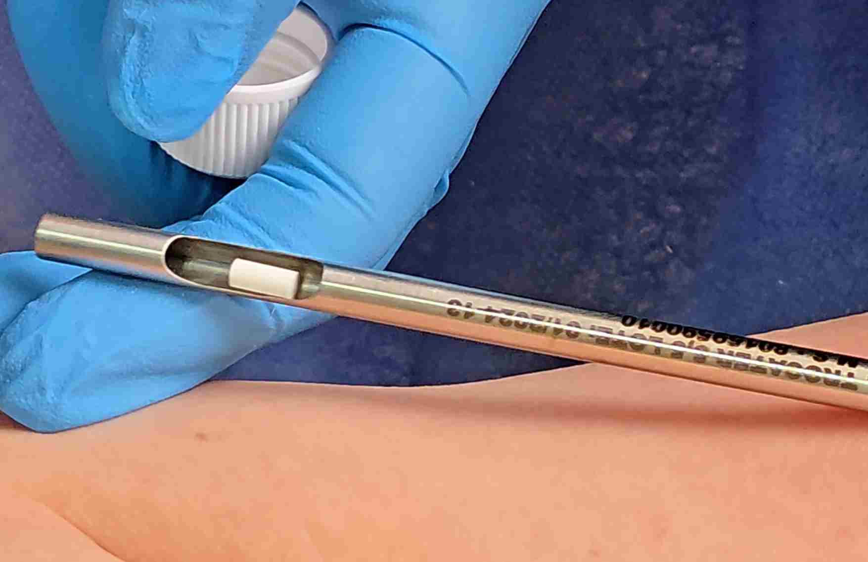 Pellet hormonal de testosterona - El chip de la sexualidad para hombres