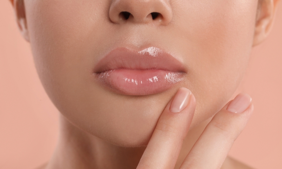 Relleno de labios - Aumento con ácido hialurónico